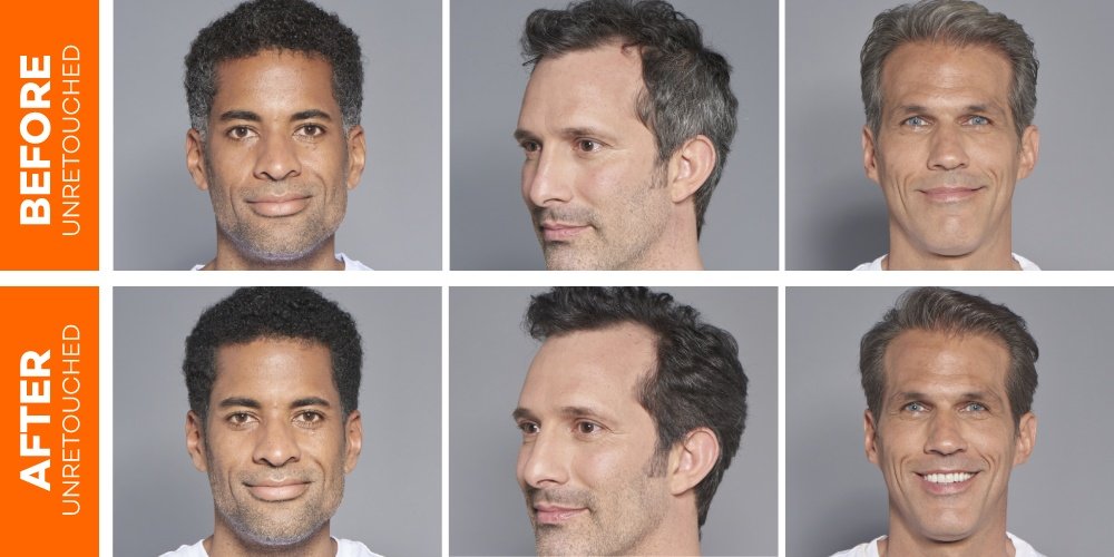 Image Before After One Twist